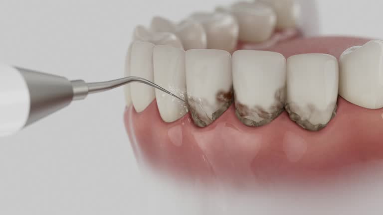 Trusted Dental Crowns And Bridges service in Jasper, GA - Dentist Open Now